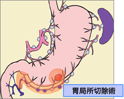 リンパ節郭清手技を究める 下部消化管編 メジカルビュー社｜消化器外科｜新DS NOW 13 リンパ節郭清手技を