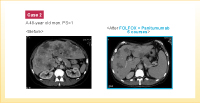 }10 CASE 2 (48΁Ej): wÖ@{sOCT